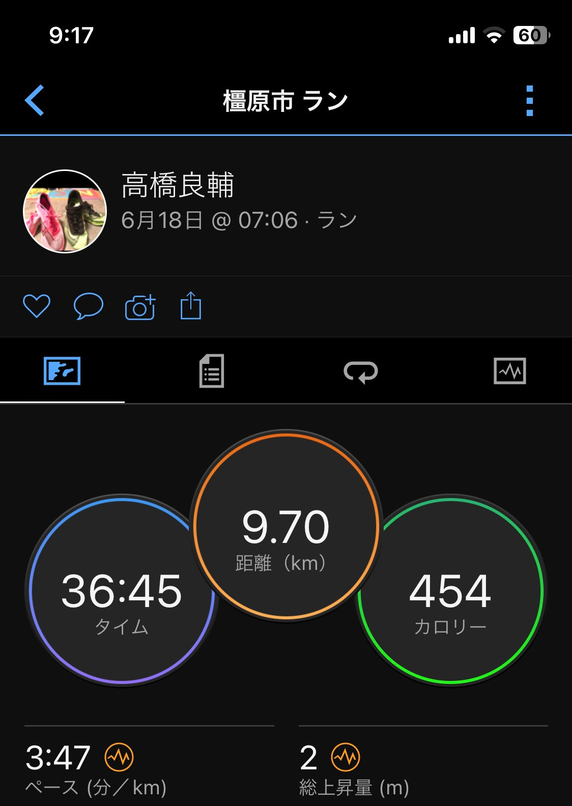 疲労